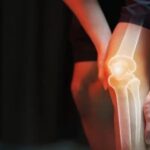 knee pain