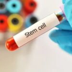 Stem Cell Transplant