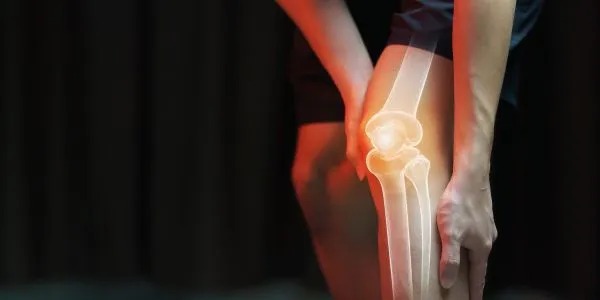 What to Expect Before and After Total Knee Replacement Surgery