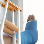 Understanding Internal Fixation: A Guide to Fracture Treatment