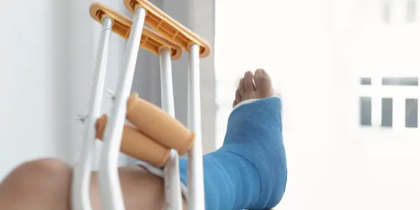 Understanding Internal Fixation: A Guide to Fracture Treatment