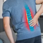 Can Tuberculosis Affect the Spine? Here's What You Need to Know