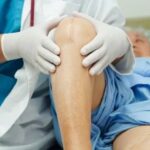 Top 10 Knee Replacement Surgery Myths and Facts: Expert Perspectives