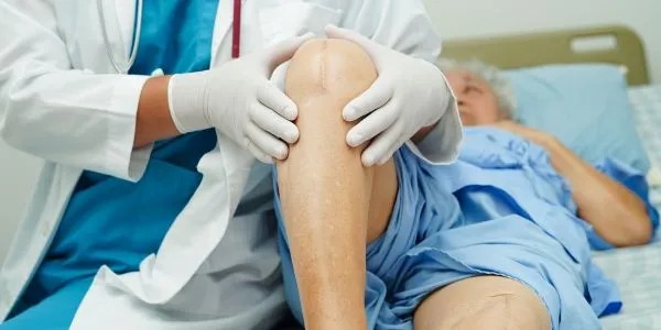 Knee Replacement Surgery Myths and Facts