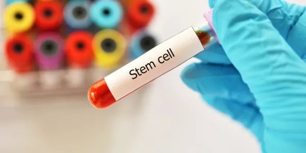 Essential Information for Cancer Patients Before a Stem Cell Transplant