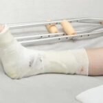 Fracture or Ligament Tear? How to Identify the Real Issue