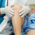 Knee Replacement Surgery Success Rate in India