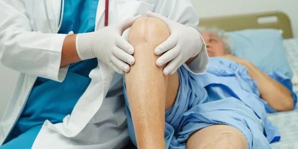 Knee Replacement Surgery Success Rate in India: A Comprehensive Guide