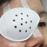 Top 7 Mistakes to Avoid After Cataract or LASIK Surgery – Eye Care Tips