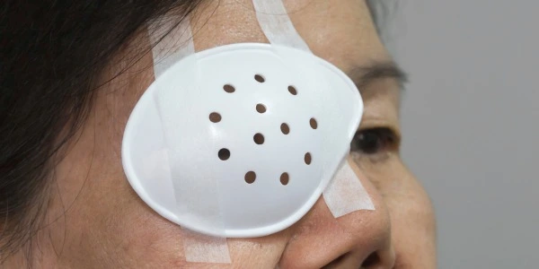 Top 7 Mistakes to Avoid After Cataract or LASIK Surgery – Eye Care Tips