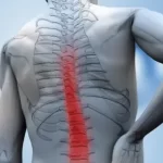 Spinal Cord Injuries: Emergency Care and Recovery Tips