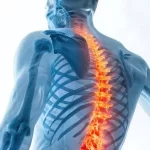 Not All Spine Injuries Damage the Spinal Cord – Know the Difference