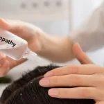Homeopathy Hair Treatment