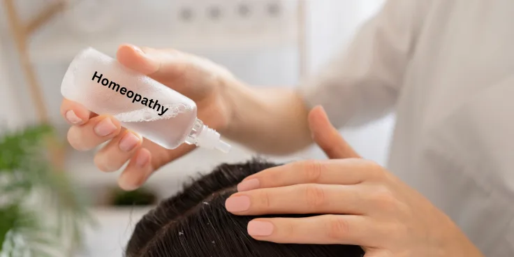 Homeopathy Hair Treatment