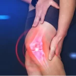 Knee Ligament Injury Treatment
